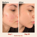 RED LIGHT THERAPY MASK