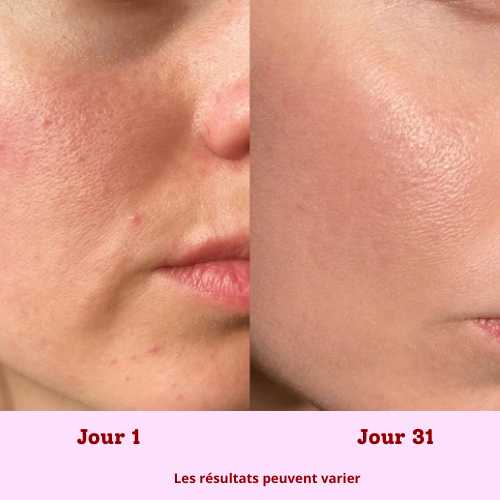 MASQUE LED POUR LE VISAGE