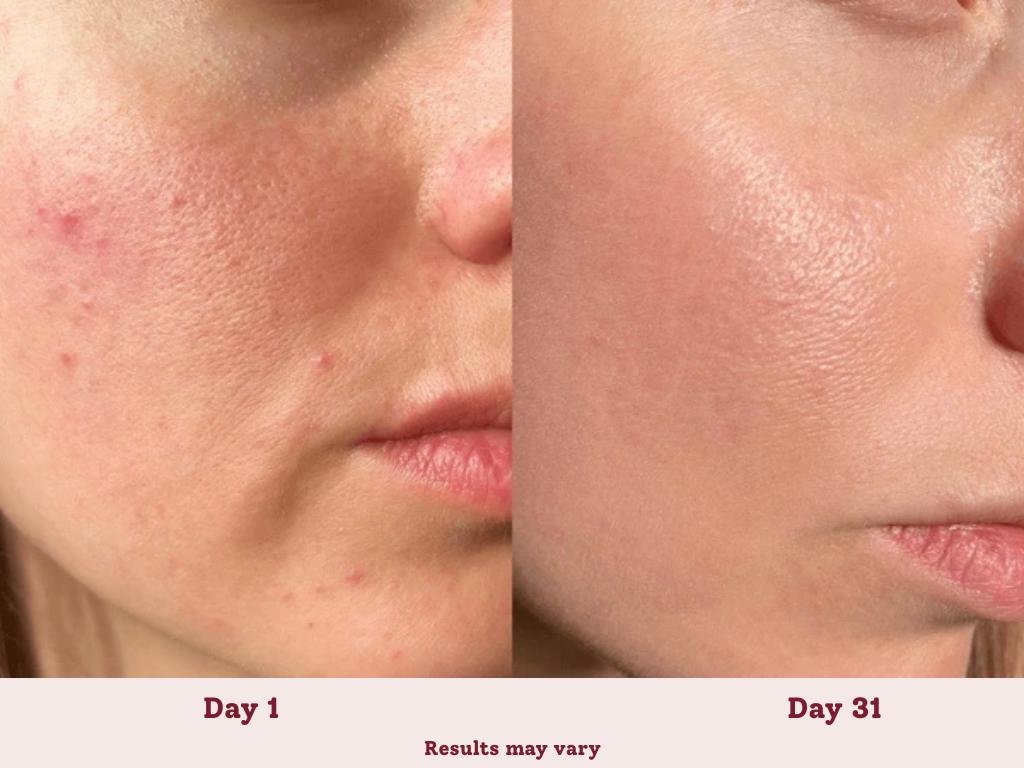 BAGUETTE DE THÉRAPIE LED