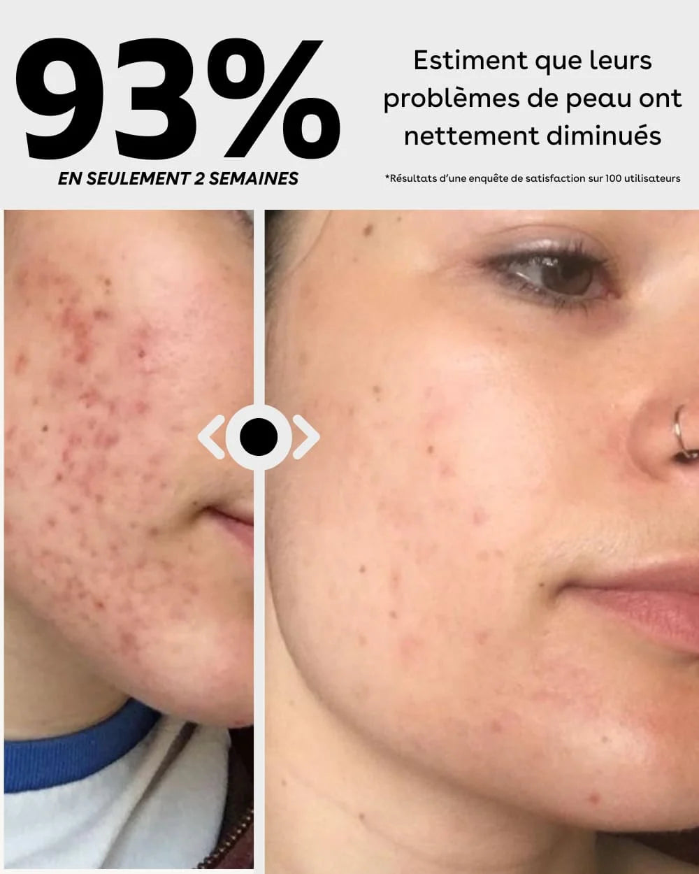 MASQUE LED POUR LE VISAGE